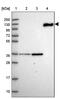 Complement C6 antibody, PA5-60527, Invitrogen Antibodies, Western Blot image 