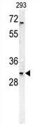 TNF Receptor Superfamily Member 6b antibody, AP54313PU-N, Origene, Western Blot image 