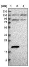 Transforming Acidic Coiled-Coil Containing Protein 3 antibody, PA5-54560, Invitrogen Antibodies, Western Blot image 