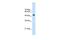 TRNA Methyltransferase 2 Homolog B antibody, GTX46162, GeneTex, Western Blot image 