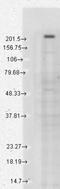 Transient Receptor Potential Cation Channel Subfamily M Member 7 antibody, NBP2-12906, Novus Biologicals, Western Blot image 