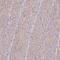 Interleukin 1 Family Member 10 antibody, PA5-63778, Invitrogen Antibodies, Immunohistochemistry paraffin image 