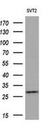 Eukaryotic Translation Initiation Factor 4E Family Member 2 antibody, MA5-25412, Invitrogen Antibodies, Western Blot image 