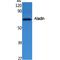 Aladin WD Repeat Nucleoporin antibody, LS-C386801, Lifespan Biosciences, Western Blot image 