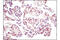 Lysine Demethylase 4A antibody, 5328S, Cell Signaling Technology, Immunohistochemistry paraffin image 
