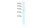 Regulating Synaptic Membrane Exocytosis 3 antibody, PA5-40964, Invitrogen Antibodies, Western Blot image 