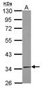 TruB Pseudouridine Synthase Family Member 2 antibody, LS-C155649, Lifespan Biosciences, Western Blot image 