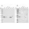 Biphenyl Hydrolase Like antibody, PA5-57798, Invitrogen Antibodies, Western Blot image 