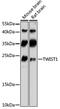 Twist Family BHLH Transcription Factor 1 antibody, 19-004, ProSci, Western Blot image 