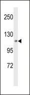 Mitogen-Activated Protein Kinase Kinase Kinase Kinase 3 antibody, LS-C164008, Lifespan Biosciences, Western Blot image 