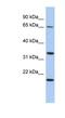 Tumor Protein P63 Regulated 1 antibody, NBP1-56560, Novus Biologicals, Western Blot image 