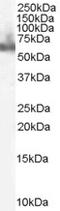 Acyl-CoA Synthetase Long Chain Family Member 4 antibody, orb18692, Biorbyt, Western Blot image 