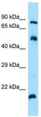 ADP Ribosylation Factor Like GTPase 4C antibody, TA333934, Origene, Western Blot image 