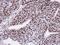 CTD Phosphatase Subunit 1 antibody, NBP1-31472, Novus Biologicals, Immunohistochemistry paraffin image 