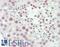 Splicing Factor 1 antibody, LS-B13200, Lifespan Biosciences, Immunohistochemistry paraffin image 