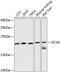 Glycine Cleavage System Protein H antibody, A07082, Boster Biological Technology, Western Blot image 