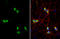 Synapsin II antibody, GTX135273, GeneTex, Immunocytochemistry image 