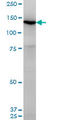 Unc-13 Homolog D antibody, LS-C139185, Lifespan Biosciences, Western Blot image 