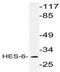 Hes Family BHLH Transcription Factor 6 antibody, AP20454PU-N, Origene, Western Blot image 