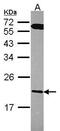 Regulator Of G Protein Signaling 10 antibody, PA5-22366, Invitrogen Antibodies, Western Blot image 