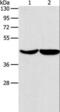 Asporin antibody, LS-B15799, Lifespan Biosciences, Western Blot image 