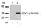 Cyclin Dependent Kinase 2 antibody, 79-165, ProSci, Western Blot image 
