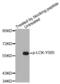 LCK Proto-Oncogene, Src Family Tyrosine Kinase antibody, abx000336, Abbexa, Western Blot image 
