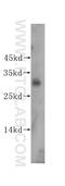 Inhibitor Of Growth Family Member 1 antibody, 16185-1-AP, Proteintech Group, Western Blot image 