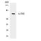 Acetylcholinesterase antibody, LS-C200076, Lifespan Biosciences, Western Blot image 