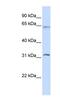 Methyltransferase Like 16 antibody, NBP1-79256, Novus Biologicals, Western Blot image 