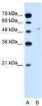 Solute Carrier Family 2 Member 6 antibody, TA333771, Origene, Western Blot image 