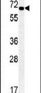 Kelch Like ECH Associated Protein 1 antibody, PA5-23601, Invitrogen Antibodies, Western Blot image 