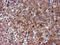 Nicotinamide N-Methyltransferase antibody, M02676, Boster Biological Technology, Immunohistochemistry paraffin image 