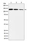 DNA Polymerase Delta 1, Catalytic Subunit antibody, M03720, Boster Biological Technology, Western Blot image 