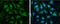 Transferrin Receptor antibody, GTX102596, GeneTex, Immunofluorescence image 