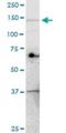 Ubiquitination Factor E4A antibody, H00009354-M08, Novus Biologicals, Western Blot image 