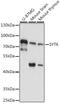 Synaptotagmin 6 antibody, A12265, Boster Biological Technology, Western Blot image 