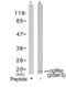 Cofilin 1 antibody, 79-170, ProSci, Western Blot image 