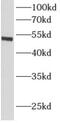 Aldehyde Dehydrogenase 1 Family Member A1 antibody, FNab00283, FineTest, Western Blot image 