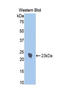 Interleukin 1 Receptor Type 1 antibody, LS-C303971, Lifespan Biosciences, Western Blot image 