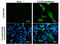 C-X-C Motif Chemokine Receptor 2 antibody, GTX631667, GeneTex, Immunofluorescence image 