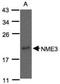 Nucleoside diphosphate kinase 3 antibody, NBP1-31093, Novus Biologicals, Western Blot image 