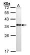 Major Histocompatibility Complex, Class II, DR Alpha antibody, PA5-27553, Invitrogen Antibodies, Western Blot image 