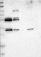 MINDY Lysine 48 Deubiquitinase 4 antibody, NBP1-91239, Novus Biologicals, Western Blot image 