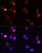 Arrestin Beta 1 antibody, 13-074, ProSci, Immunofluorescence image 