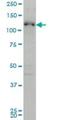 ABL Proto-Oncogene 2, Non-Receptor Tyrosine Kinase antibody, H00000027-M03, Novus Biologicals, Western Blot image 