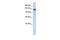 NODAL Modulator 1 antibody, GTX45346, GeneTex, Western Blot image 