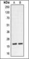 Calcineurin Like EF-Hand Protein 2 antibody, orb375959, Biorbyt, Western Blot image 