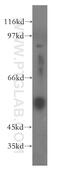 Fibrinogen Gamma Chain antibody, 15841-1-AP, Proteintech Group, Western Blot image 