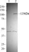 Protein Tyrosine Kinase 2 antibody, 700255, Invitrogen Antibodies, Western Blot image 